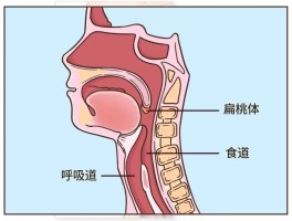 扁桃体的位置图片(人体扁桃体的位置图片)