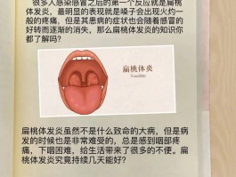 治疗扁桃体发炎的方法(治疗扁桃体发炎的方法有哪些)